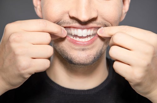 Lifestyle and teeth whitening